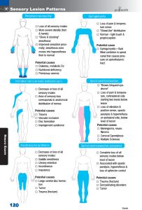 120 sensory nerve loss patterns