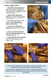 Evidence Informed Introduction to IASTM 2nd Edition Sample Pages